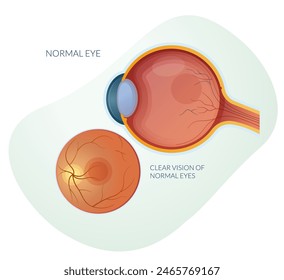 Normal Eye without any Dry or Wet Macular Degeneration - Stock Illustration as EPS 10 File