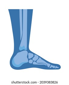 normal feet joints and bones