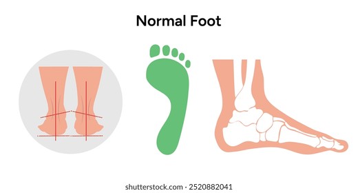 Normal foot and footprint. Orthopedist diagram infographic