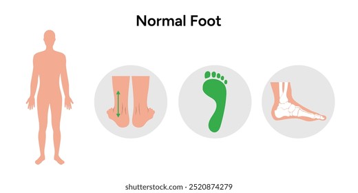 Normal foot. Orthopedist diagram infographic