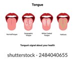 Normal geographic white and halitosis tongues