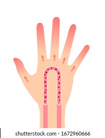 Normal Hand Blood Circulation Illustration / No Text