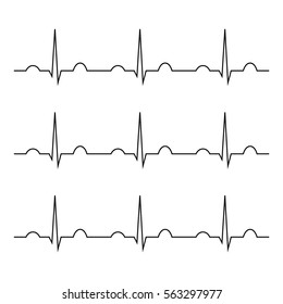 normal heart rhythm ekg vector