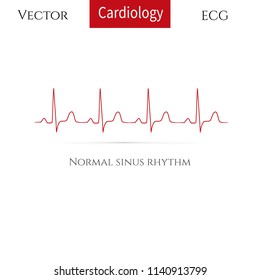 Normal Heart Rhythm( Normal Sinus Rhythm). Vector Illustration.