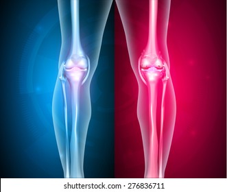 Normal leg knee joint at the blue background and unhealthy joint at the red background