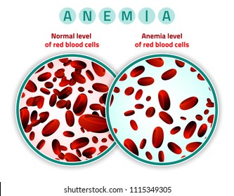 Range hemoglobin normal Hemoglobin test