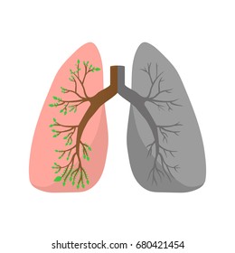 Normal lung and lung cancer illustration