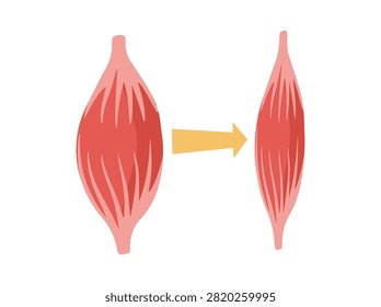 Normal Muscular and Dystrophy Atrophy