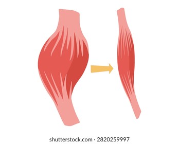 Normal Muscular and Dystrophy Atrophy