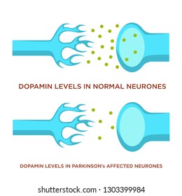 Normal Neurons And With Parkinson Disease Dopamine Level Vector Human Body Sickness Nerves Dysfunction Neurology And Neurotransmitters Medical Problem Organism Disorder Healthcare And Treatment