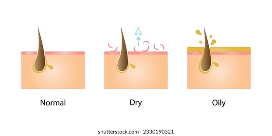 Normal, oily, and dry pores. Human Skin types and conditions on white background. Vector illustration.