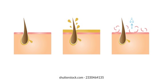 Normal, oily, and dry pores. Human Skin types and conditions on white background. Vector illustration.