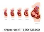 Normal pregnancy anatomy stages from conception to childbirth. Anatomy medical infographic vector illustration