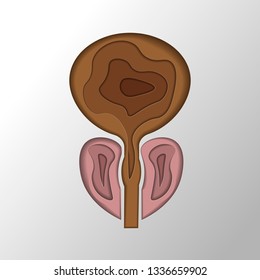 normal prostate and acute prostatitis. Medical illustration paper cut style