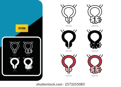 Normal prostate and benign pro-static hyperplasia. Bladder surgery urologist. Vector icon set