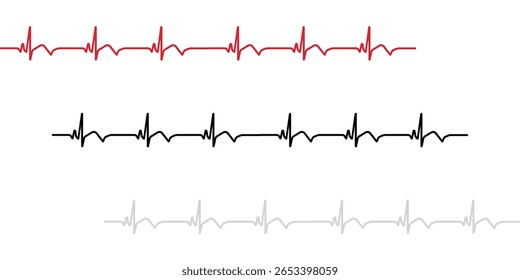 Ritmo normal e três graus de diagrama de bloqueio AV para o coração humano. Diagrama do ritmo normal e bloqueio AV de um coração humano. Ilustração vetorial em estilo plano isolada em fundo branco.