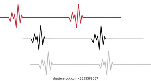 Normaler Rhythmus und drei Grad AV-Blockdiagramm für das menschliche Herz. Diagramm des normalen Rhythmus und AV-Block für ein menschliches Herz. Vektorgrafik im flachen Stil einzeln auf weißem Hintergrund.