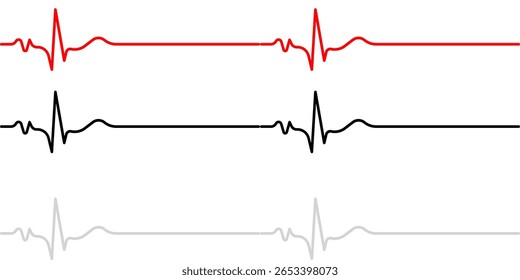 Ritmo normal e três graus de diagrama de bloqueio AV para o coração humano. Diagrama do ritmo normal e bloqueio AV de um coração humano. Ilustração vetorial em estilo plano isolada em fundo branco.