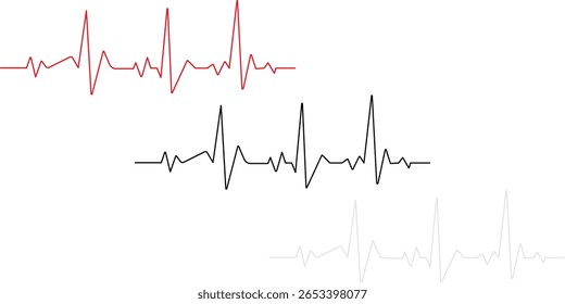 Ritmo normal e três graus de diagrama de bloqueio AV para o coração humano. Diagrama do ritmo normal e bloqueio AV de um coração humano. Ilustração vetorial em estilo plano isolada em fundo branco.