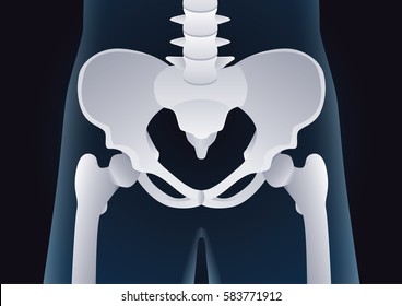 Normal shape of human pelvic bone in X-ray concept. Illustration about medical and health.