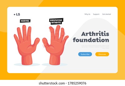 Normal and Sick Hands with Rheumatoid Arthritis Landing Page Template. Finger Joints Inflammation Healthcare, Treatment in Hospital. Osteoarthritis Autoimmune Disease. Cartoon Vector Illustration
