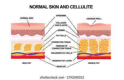 66 Normal Face Skin Texture Images, Stock Photos & Vectors | Shutterstock