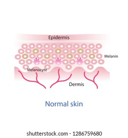 Normal Skin Layer Melasma Skin Layer Stock Vector (Royalty Free) 2133311457