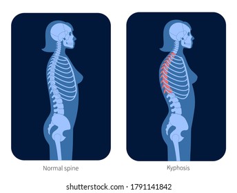 Female Backbone Images Stock Photos Vectors Shutterstock