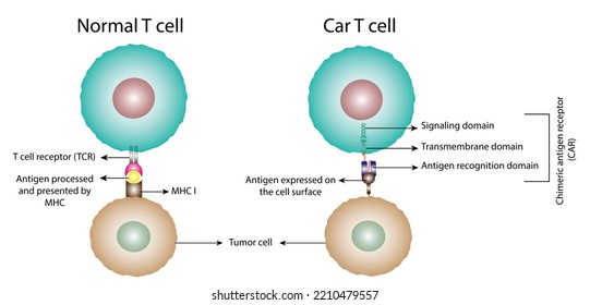 Normal T Cell And Chimeric Antigen Receptor T Cell ,CAR T Cell, For Use In Immunotherapy. Chemotherapy. Vector Illustration.