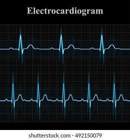 Normal and tachycardial ecg charts, 2d medical vector illustration on dark grid background, eps 8