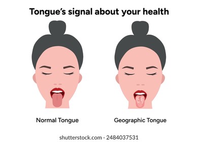 Normal tongue and geographic tongue problem