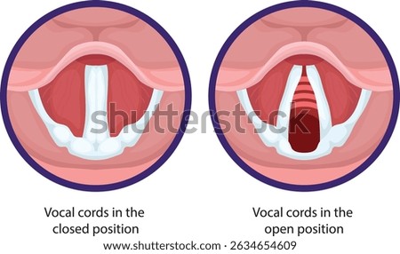 Normal vocal cords are paired structures located within the larynx, responsible for sound production, breathing, and airway protection.
