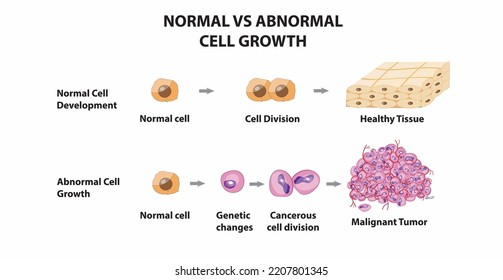 Normal vs Abnormal Cell growth and development, Vector, illustration