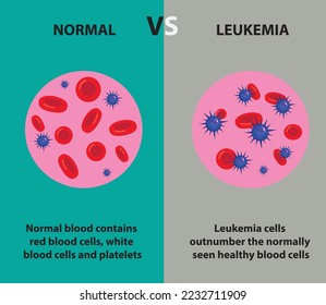 NORMAL VS LEUKEMIA CONDITION. ILLUSTRATION AND VECTOR