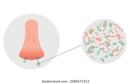 Nose infection virus or allergy symptoms with runny nose and zoom bacterials. Cold and flu sneeze treatment