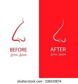 Nose reshaping before and after surgery. Abstract  illustration isolated on a white and red background.Template for business card and banner