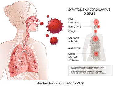 Novel Coronavirus (2019-nCoV) Stop. Human MERS-Cov Symptoms Risk Factors. Virus Outbreak Spread Pandemic. Health And Medical Testing, Screening. Respiratory, Breathing. Vector Diagram Infographic