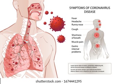 Novel Coronavirus (2019-nCoV) Stop. Human MERS-Cov Symptoms Risk Factors. Virus Outbreak Spread Pandemic. Health And Medical Testing, Screening. Respiratory, Breathing. Vector Diagram Infographic