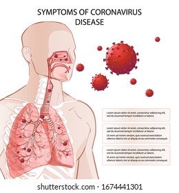  Novel coronavirus (2019-nCoV) stop. Risikofaktoren für humane MERS-Cov-Symptome. Virusausbruch verbreitet Pandemie. Gesundheits- und medizinische Untersuchungen, Screening. Atmung, Atmung. Infografik zur Vektorillustration