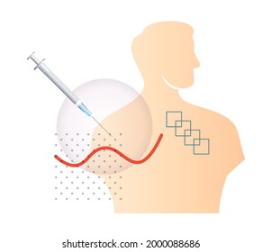 Novel Coronavirus - Vaccination Program - Illustration as EPS 10 File