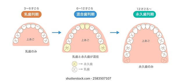 The number of teeth changing with age, the newly erupting teeth, and the alignment of the teeth.[Translate]Mixed Dentition,Primary dentition,Permanent dentition