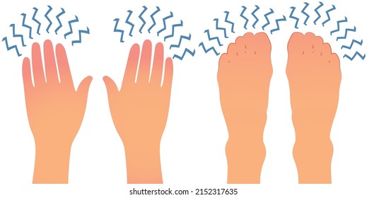 Numbness in hands and feet concept vector illustration on white background. Man or woman feeling pain in hand and feet.