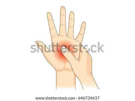 Numbness in one hand. Illustration about loss of sensation or feeling in hand or fingers.