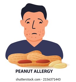 Problema de los síntomas de alergia a las nueces. Carácter humano hinchado.Reacción alérgica a los cacahuetes.Vector de ilustración plano.Aislado sobre un fondo blanco.