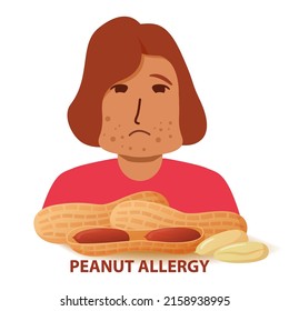 Problema de los síntomas de alergia a las nueces. Carácter humano hinchado.Reacción alérgica a la niña de cacahuetes.Vector de ilustración plano.Aislado sobre un fondo blanco.