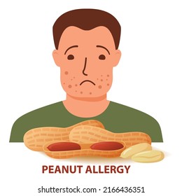 Nut allergy symptoms problem .Swollen man character.Allergic reaction to peanuts.Flat illustration vector.Isolated on a white background.