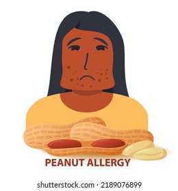 Nut allergy symptoms problem .Swollen man character.Allergic reaction to peanuts girl.Flat illustration vector.Isolated on a white background.