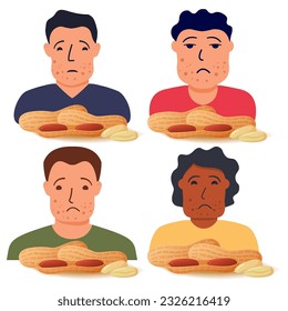 Problema de los síntomas de alergia a las nueces. Carácter humano hinchado.Reacción alérgica a los cacahuetes.Vector de ilustración plano.Aislado sobre un fondo blanco.