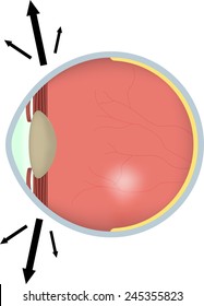 Nystagmus