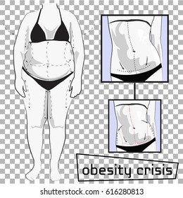 Obesity crisis. Before and after. Vector Illustration. Overweight woman.